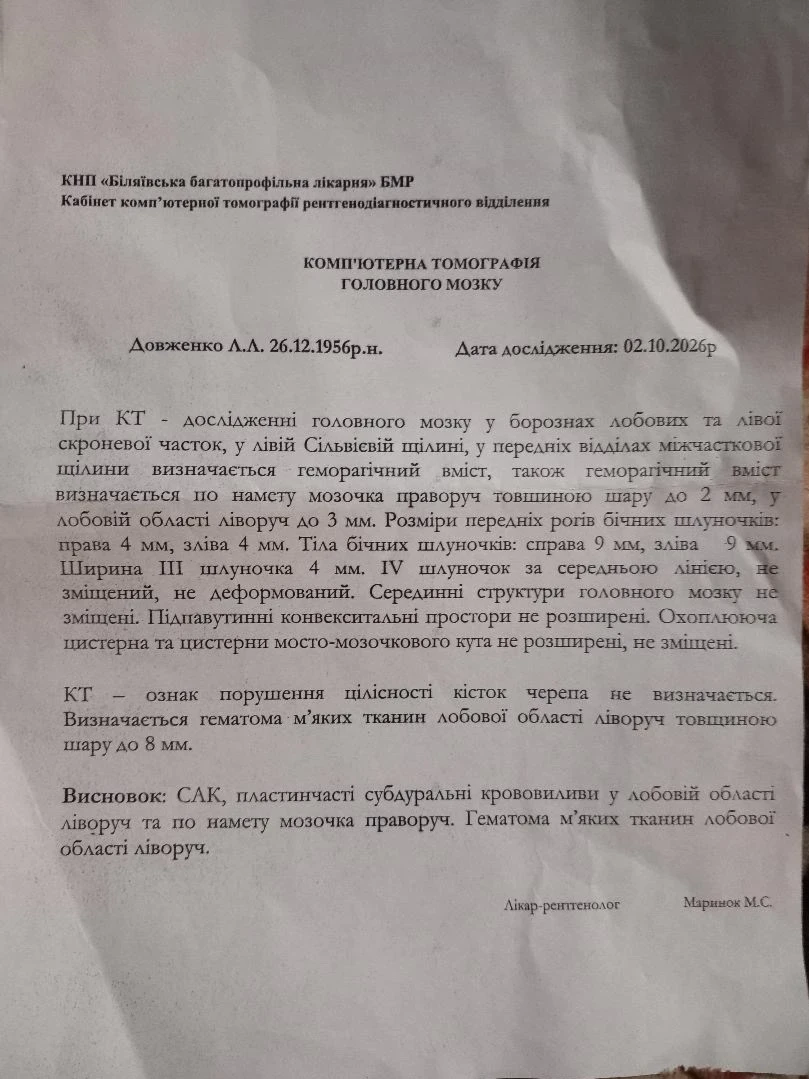 Комп'ютерна томографія Любові Довженко