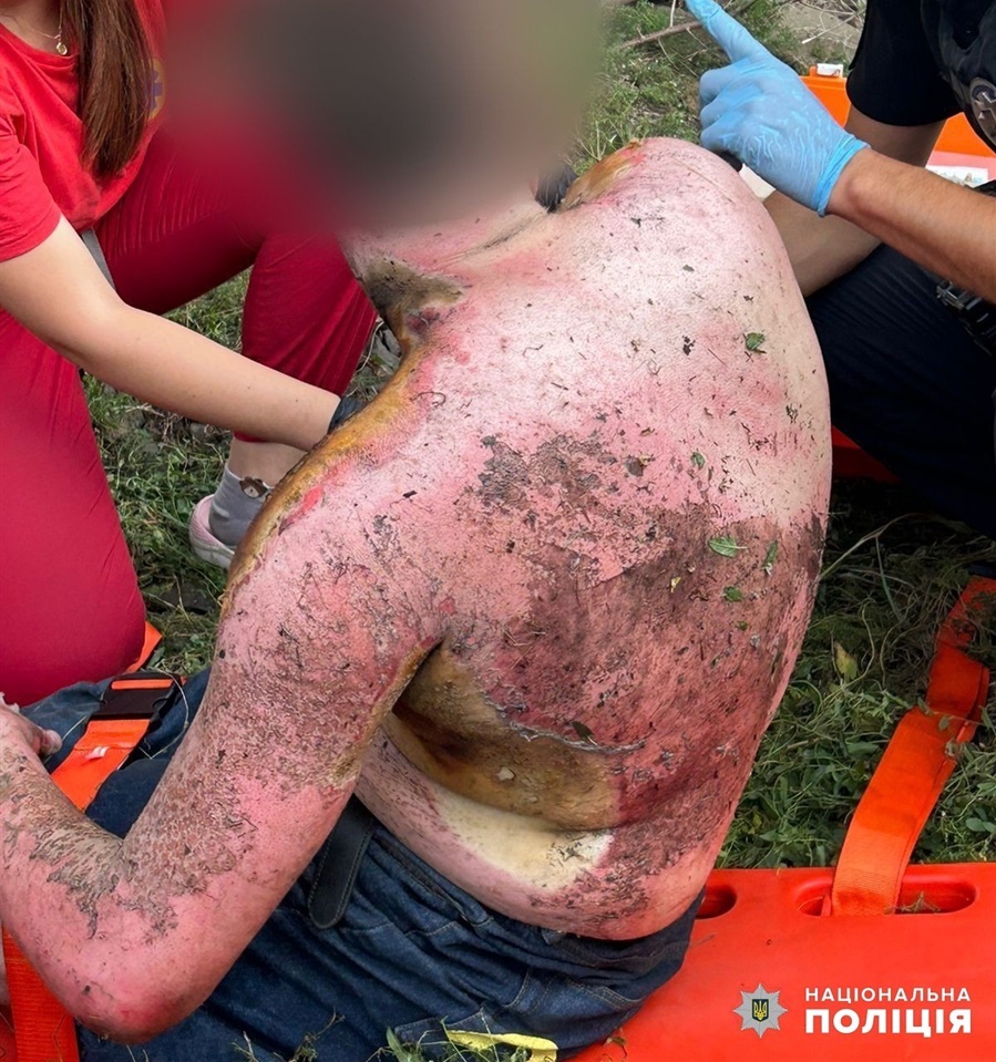 Вдарило струмом підлітків на залізничній станції Одещина