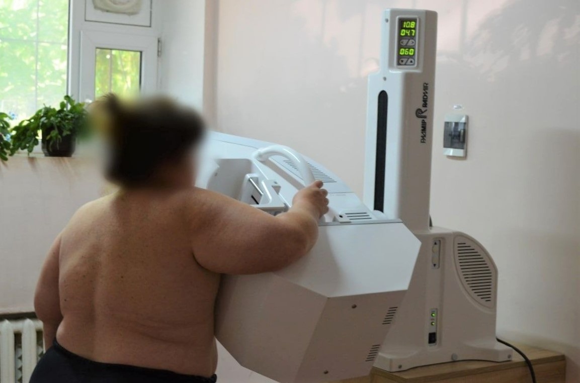 Кабінет мамографії в Біляївській лікарні. Так проходить обстеження на мамографі