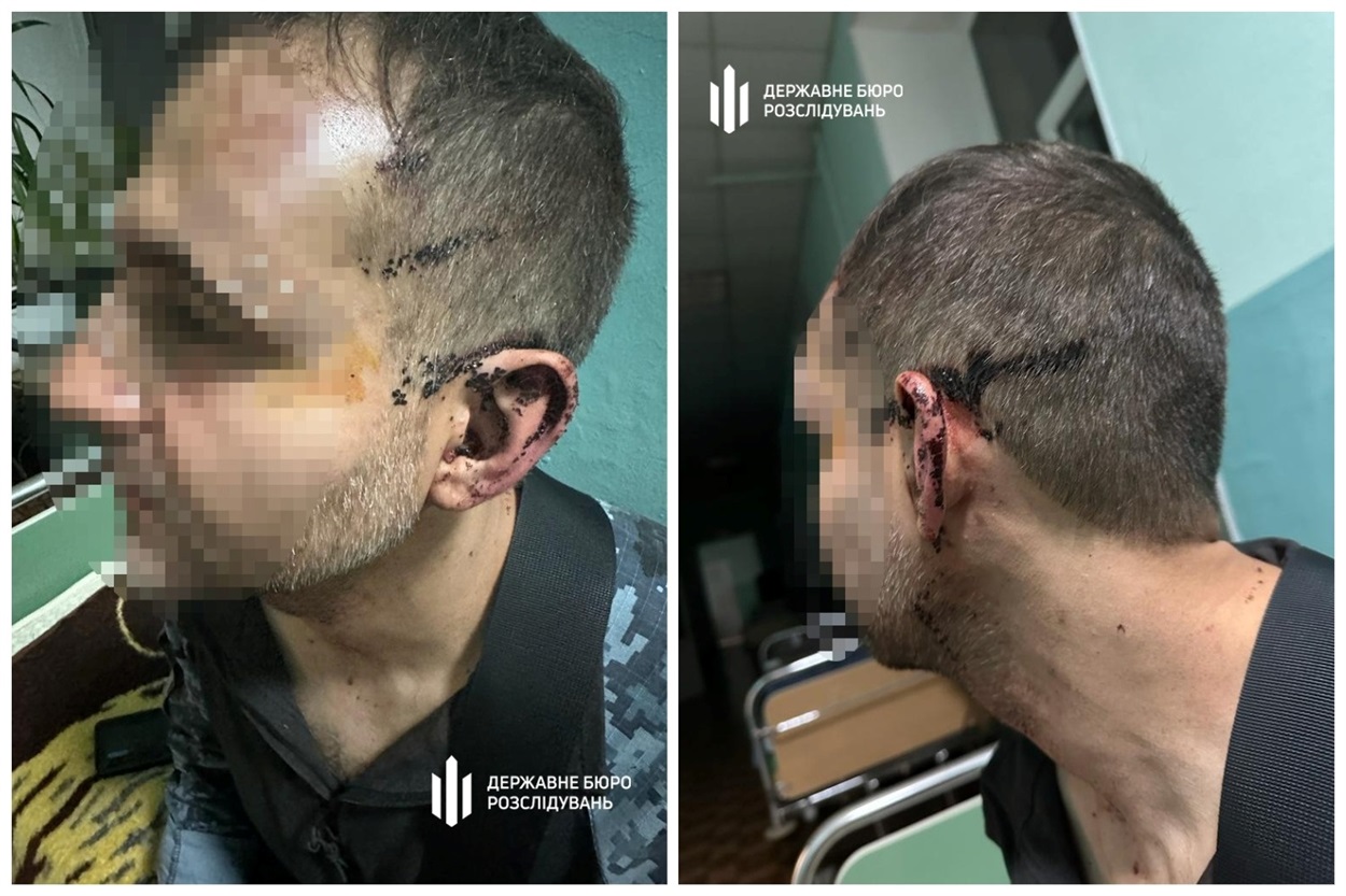 Побили військового у військовій частині Одещина