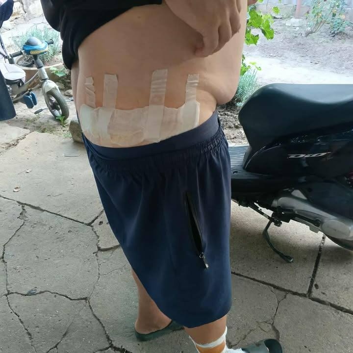 У Біляївці собака без намордника напав на чоловіка та дитину з інвалідністю