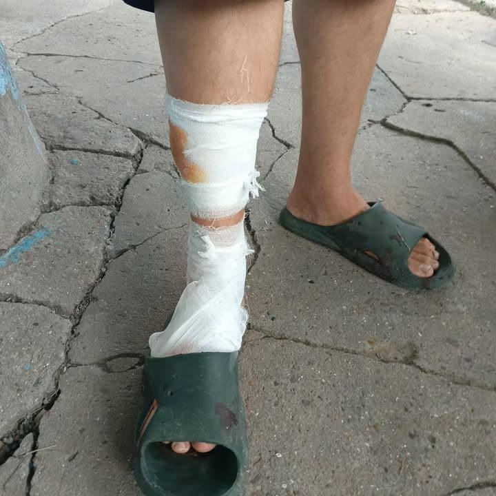 У Біляївці собака без намордника напав на чоловіка та дитину з інвалідністю